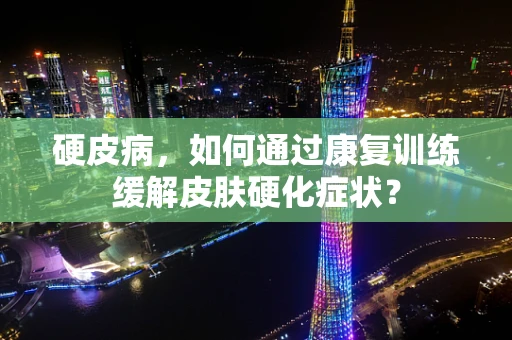 硬皮病，如何通过康复训练缓解皮肤硬化症状？