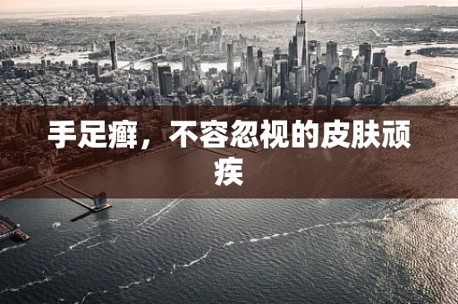手足癣，不容忽视的皮肤顽疾